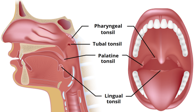Anatomical-Location-of-the-Tonsils-Waldeyers-Ring